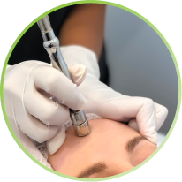 Microdermabrasion