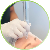 Skin Needling