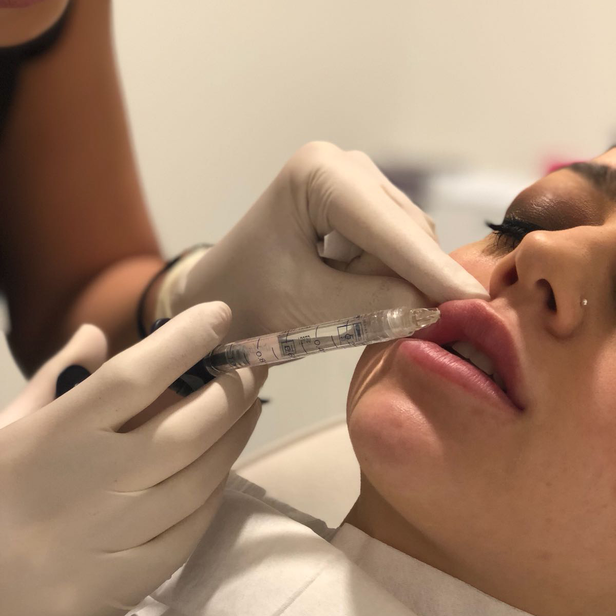 lips injection
