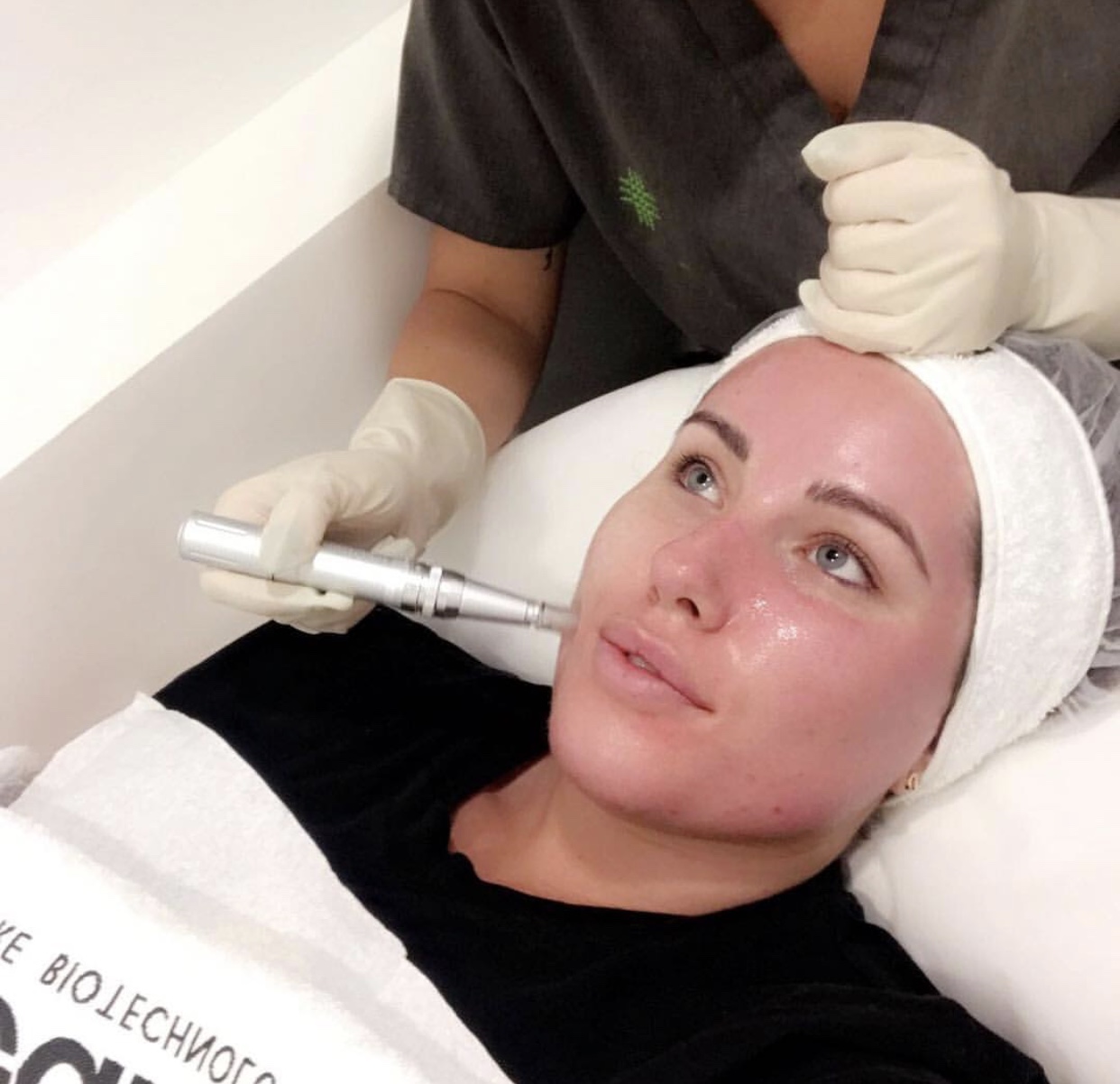 facial treatment