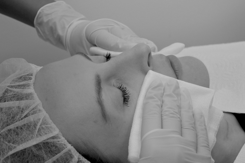facial treatment
