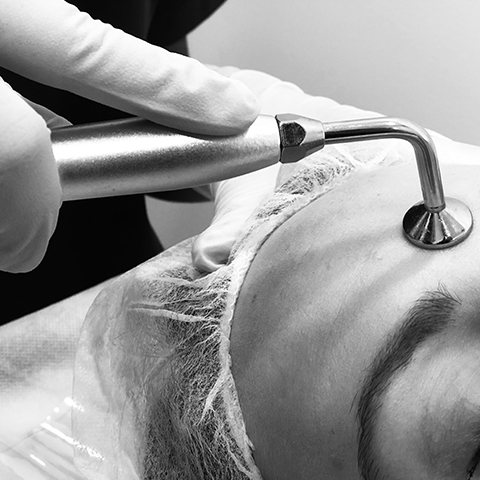 facial treatment