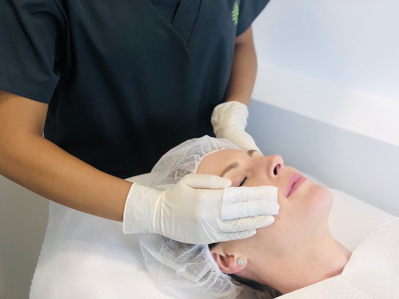 facial treatment