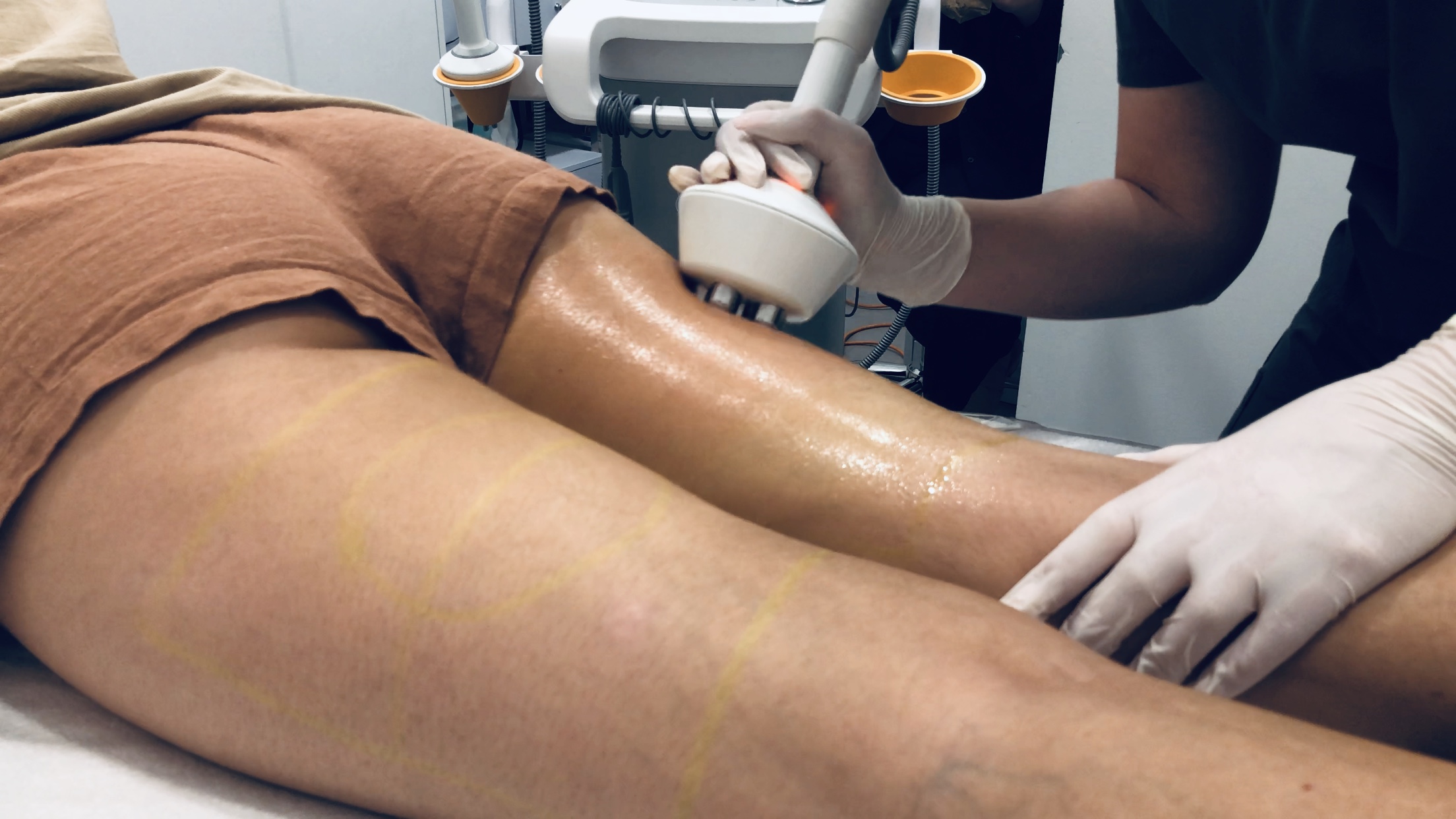 skin treatment