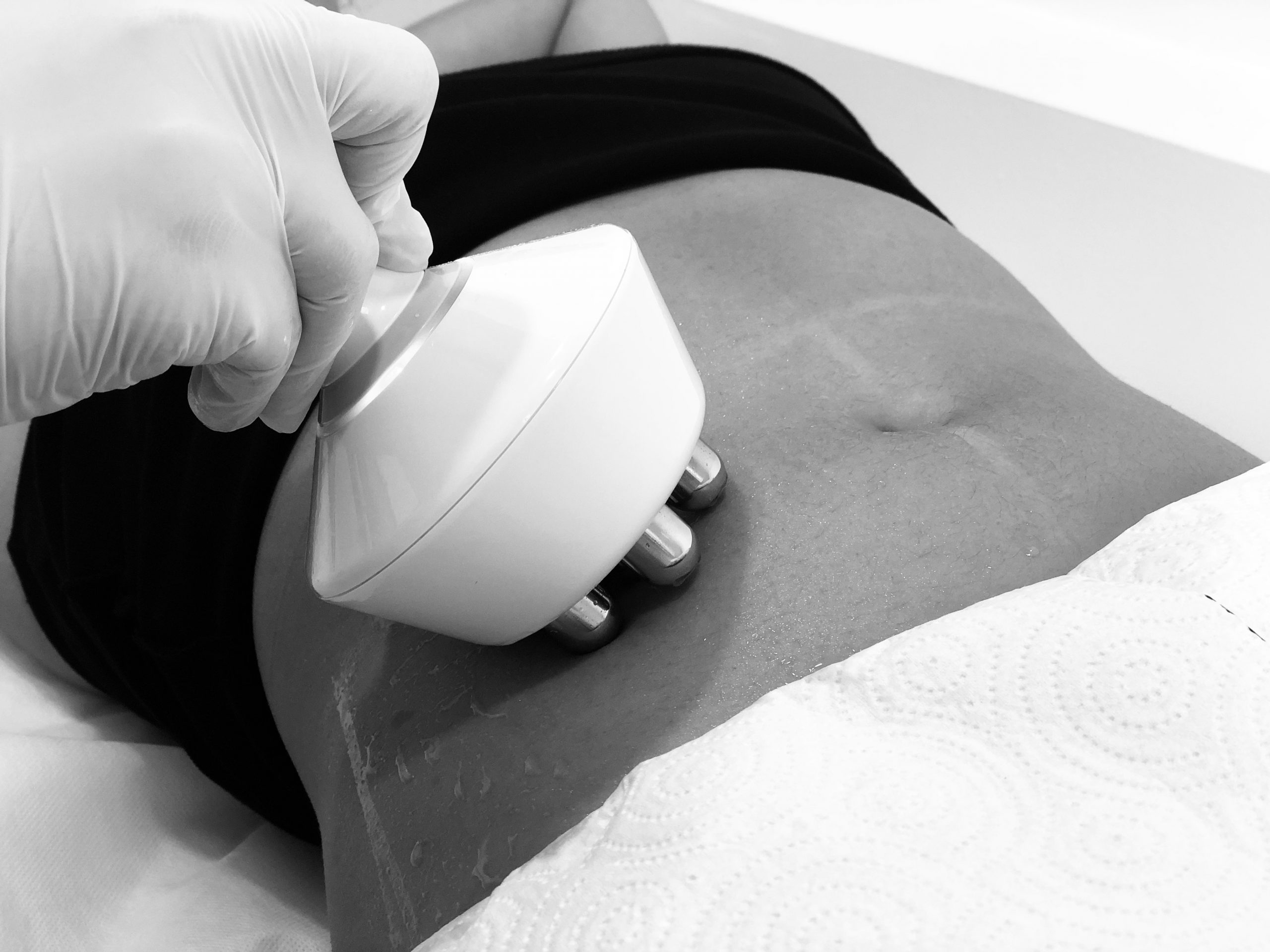 360 RESULTS BLOG CELLULITE