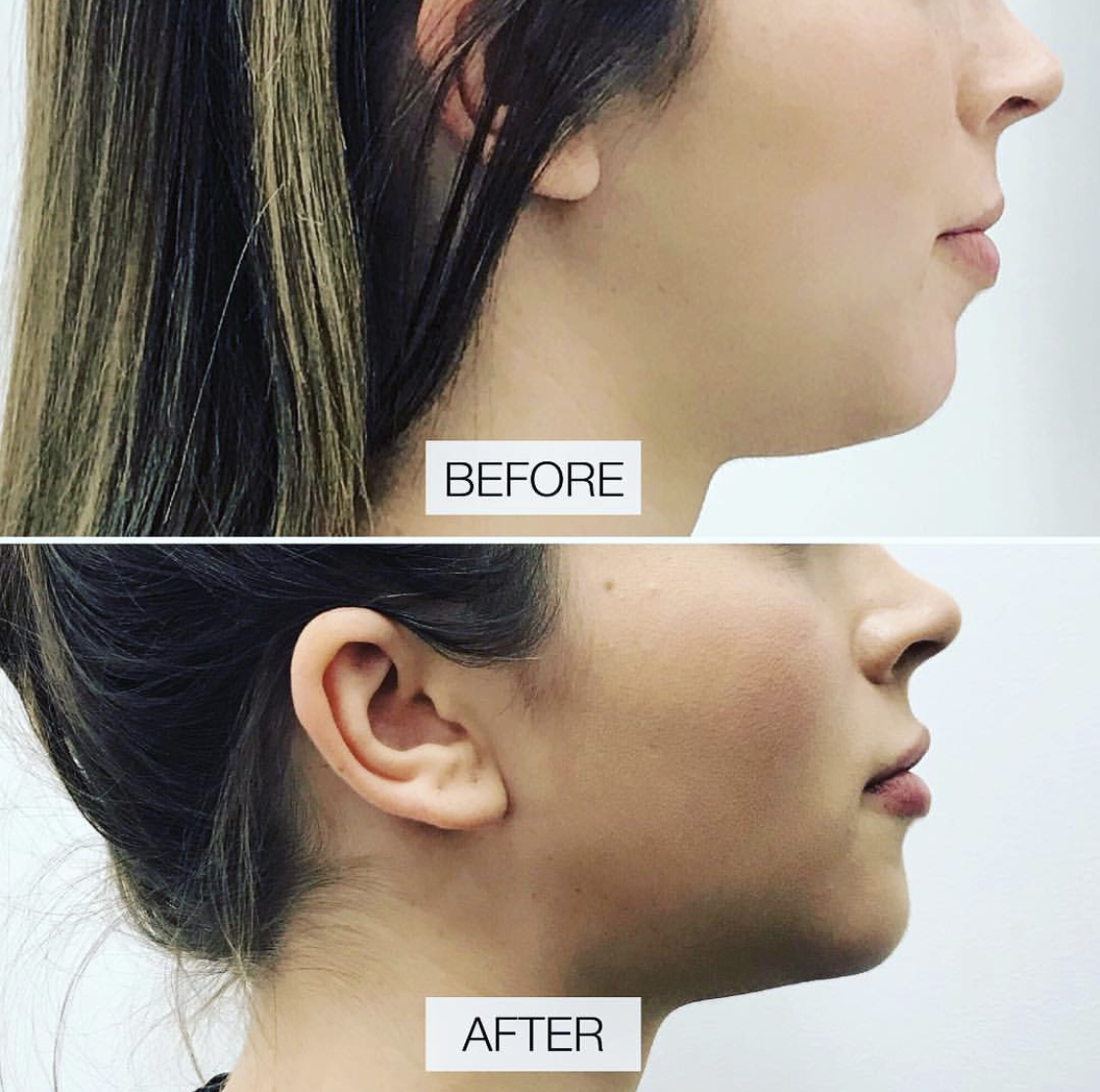 before and after