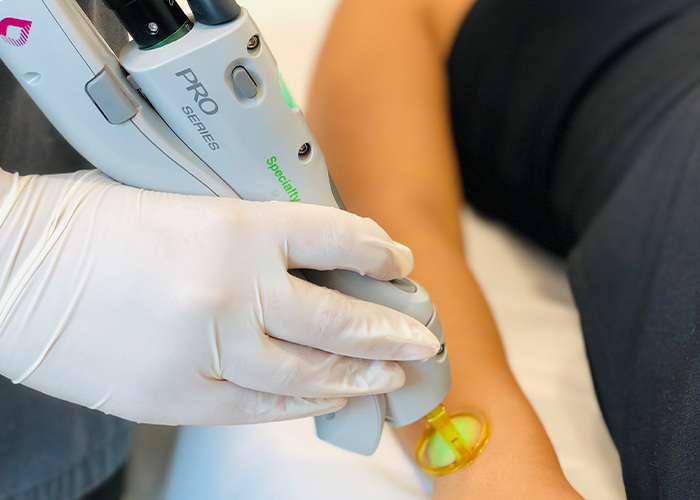 Results Laser Hair Removal Clinic in Wollongong Results Laser Clinic