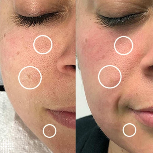 dry skin treatments
