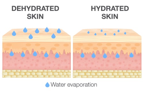 treating dry skin