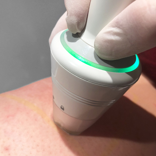 skin treatment