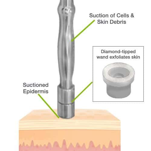 4 skin exfoliating tool