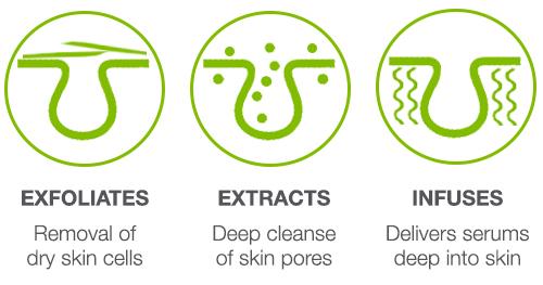 Microdermabrasion benefits