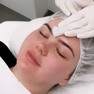 Chemical Peel - Pigmentation Peel + LED Light Therapy Combo