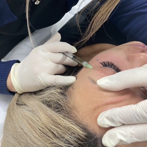 Should I get Eye Rejuvenation Therapy?