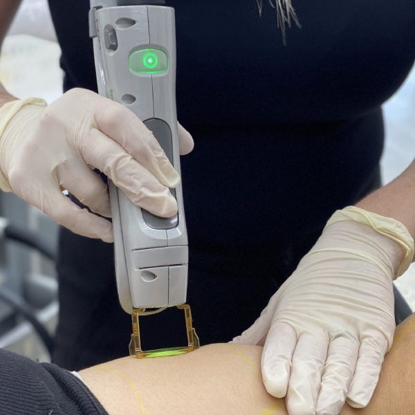 Laser Hair Removal Myths: Setting the Record Straight